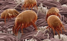 aca6f6a4578dfa837640286fdfd31485--dust-mite-allergy-allergy-treatment