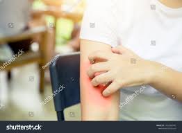 Dermatitis and Skin Disorders. Skin allergy patch&nbsp;testing.